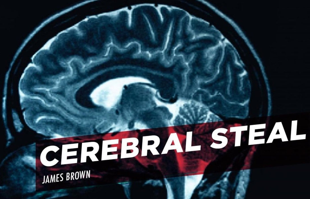 Cerebral Steal - By James Brown - INSTANT VIDEO DOWNLOAD - Merchant of Magic